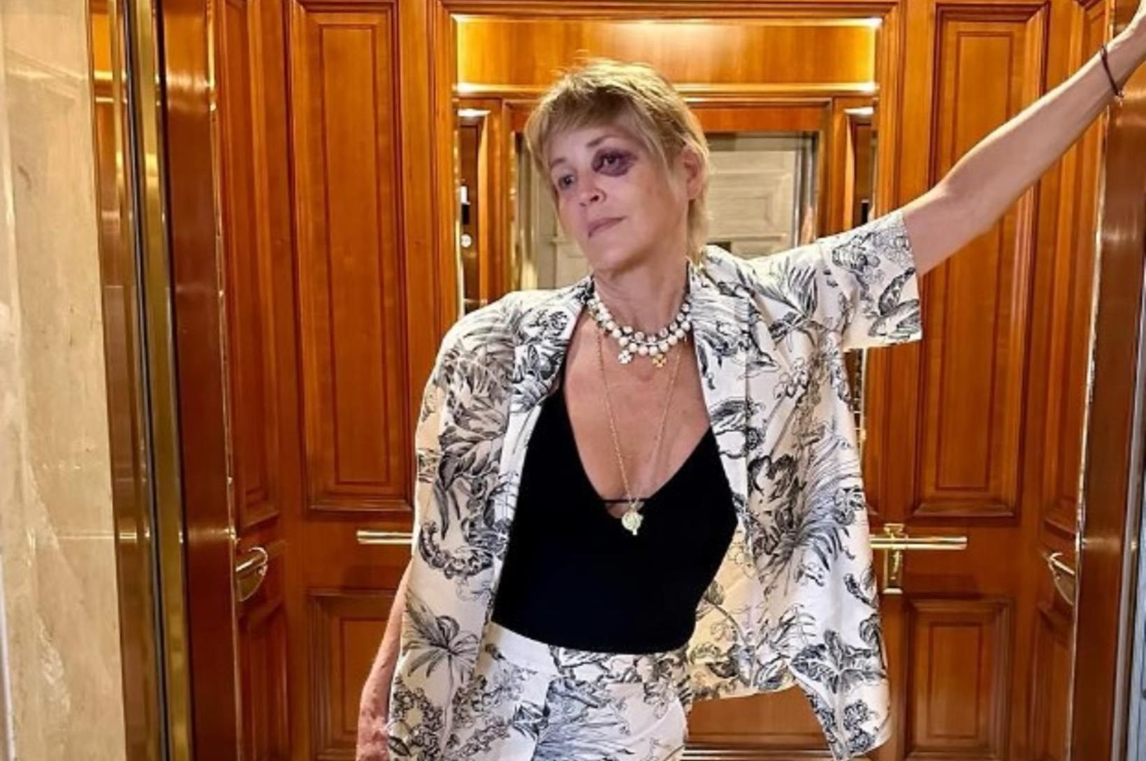 Sharon Stone skartar myndarlegu glóðarauga