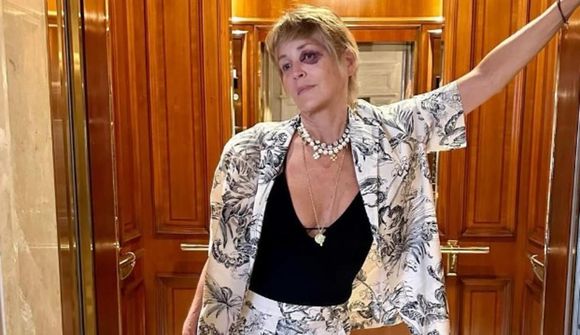 Sharon Stone skartar myndarlegu glóðarauga
